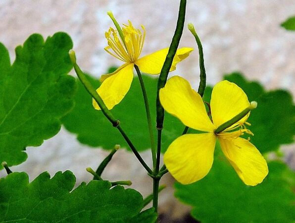 Celandine για τη θεραπεία της ψωρίασης